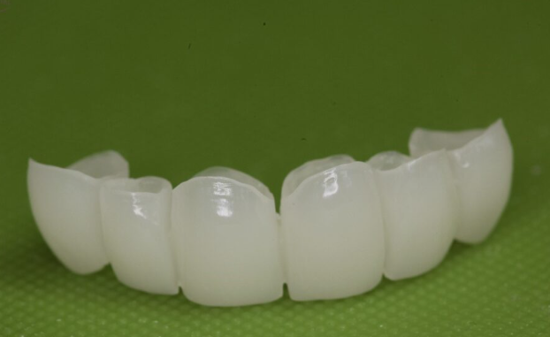 PMMA Crown